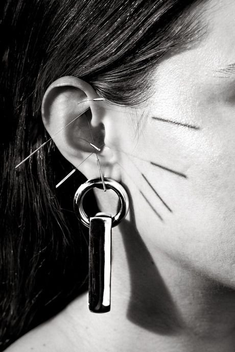 Acupuncture